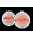 Βάλσαμο Χειλιών O'Keeffe's - Stick με Καταπραϋντική Αίσθηση - 4.2g