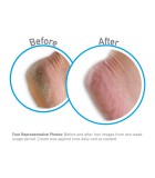 O'Keeffe's Healthy Feet