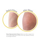 O'Keeffe's Cream Skin Repair O'Keeffe's Cream Skin Repair